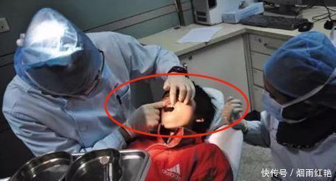 孙子|4岁男孩被鱼刺卡喉,奶奶“两招”救了孙子,医生:姜还是老的辣