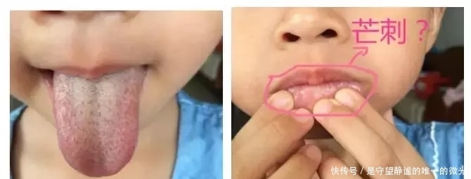  便秘|长期便秘，羊屎蛋，便秘腹泻交替的根本原因