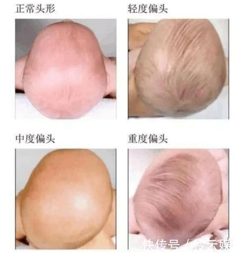 爸妈|孩子长得丑，真得怪家长！爸妈的这种行为，毁了多少孩子的颜值！