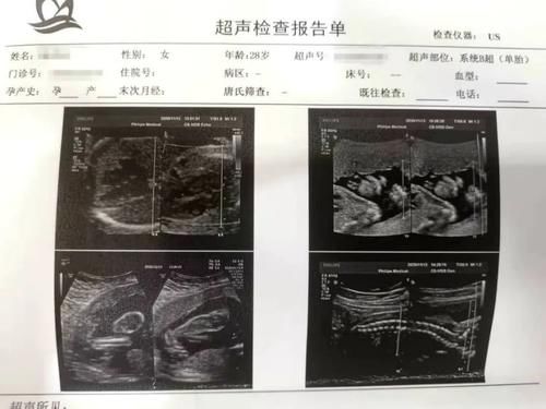 孕期发现胎儿马蹄足是“留”还是“流”？|健康宣教 | 孕期超声