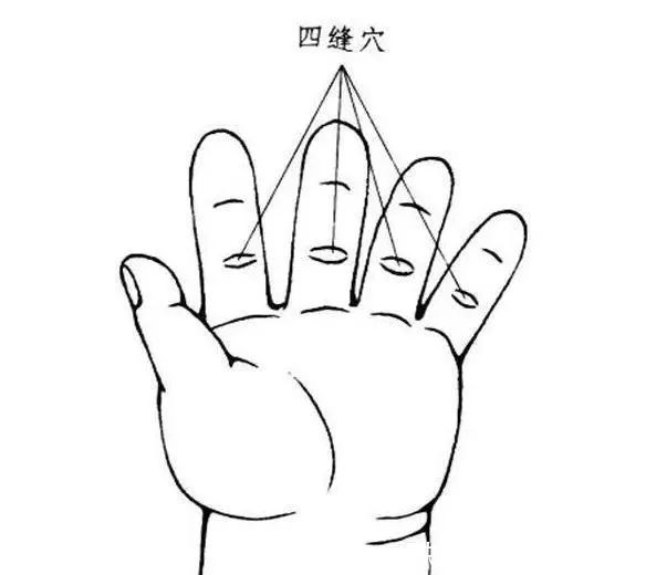 27岁女子，查出肠癌，无奈放弃治疗，提醒：1种食物不能天天吃