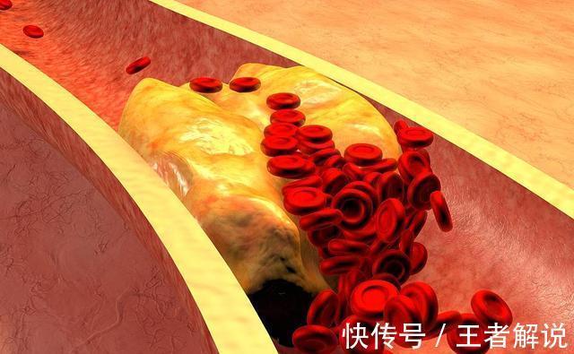 医生|血压正常,却经常头晕?医生:6种疾病平时多留意