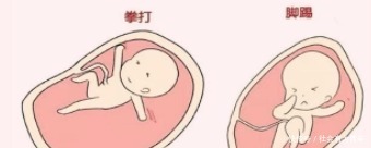 孕期这些胎动极不正常, 若疏忽大意, 可能酿早产或流产！