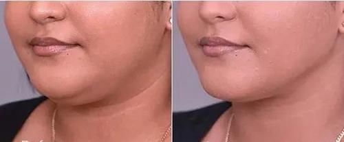 你周围大脸的女生多吗？拥有一张大脸是种怎样的感受？