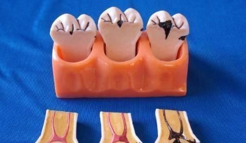 父母|2岁孩子满嘴“小黑牙”,医生不是因为糖,是父母的无知