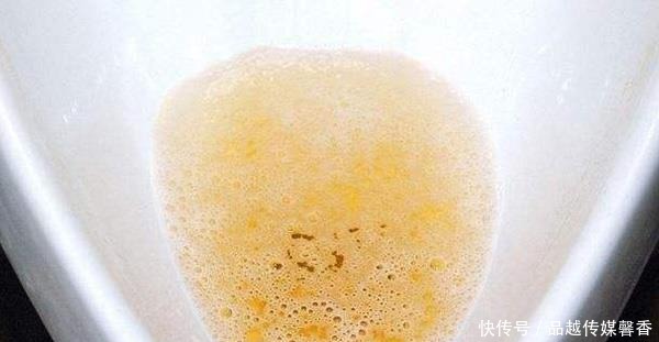  或许|肾好的人，尿液多半没有以下表现，若你也没有，肾或许还不错