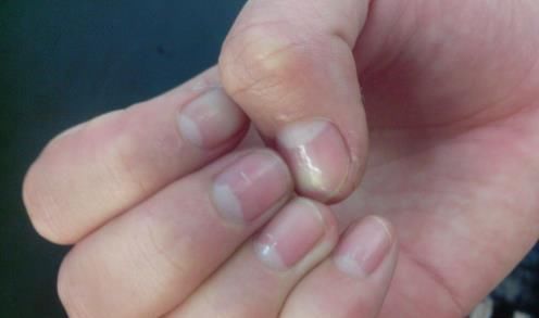 半月形|从双手就能判断女性气血是否足，3个方法补血快速养出好气色