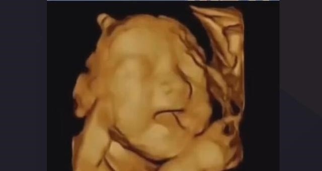 胎儿|怀胎十月“注意事项”一览表，孕妈收藏备用，愿宝宝顺利出生！