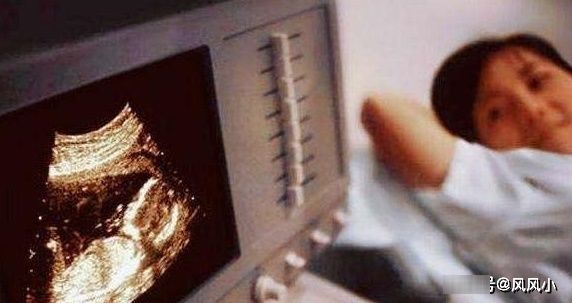 孕期|产检时，单子上若有几种数据，也许怀“男宝”的可能比较大