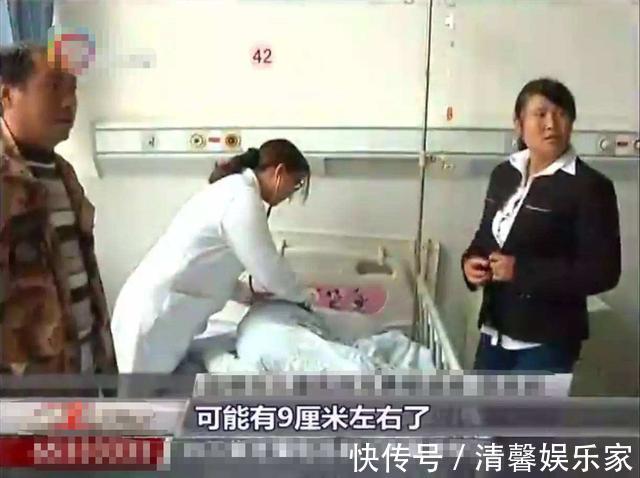 检查|4岁女孩常流鼻血,去医院检查却被送手术室,妈妈表示都怪我
