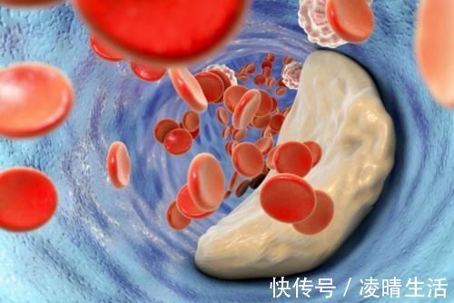 王爷爷|71岁老人顿顿吃肉,血管依旧通畅,医生:坚持3件事,你也可以