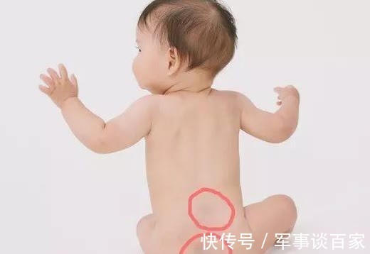 秀秀|大部分宝宝屁股发青,和“前世”有啥关系?来了解这些原因