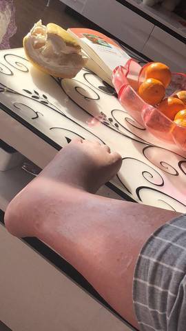 腹部|湿气重的人，身体3处是“圆”的，如果你也有，尽早祛湿