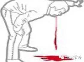 急诊科三天连收近10例，极度凶险！春节千万要警惕！