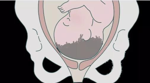 过程|顺产“开十指”是怎么开的一组过程图让你明白什么叫为母则刚