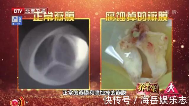 心脏|看起来是感冒,实际是心脏出了问题!血液检查几项指标很重要