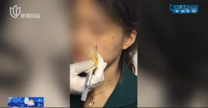 王院长|这家培训中心不简单!想学美容反遭毁容