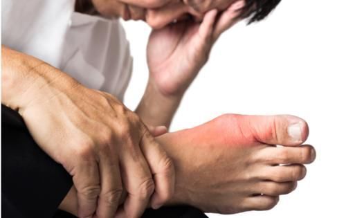 食物|痛风的“头号杀手”找到了，常吃这3种食物，7天让尿酸一泻千里