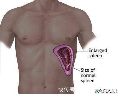 高龄|高龄老中医：肝出了问题, 基本都是肝癌晚期了，3大信号: 手上、脸上、嘴里全都有