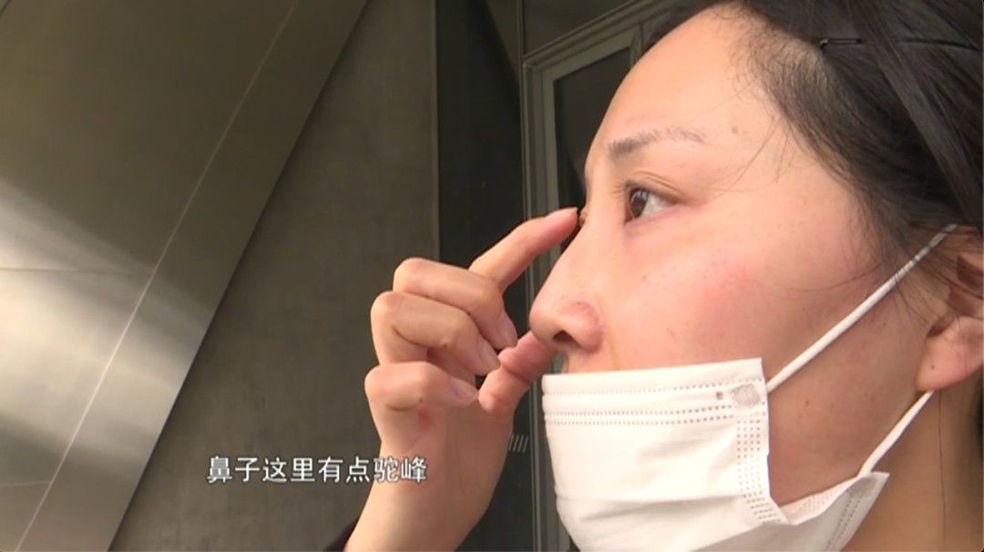 3天就变回原样！女子花高价注射玻尿酸中的“爱马仕”，结果却入了个“无底洞”