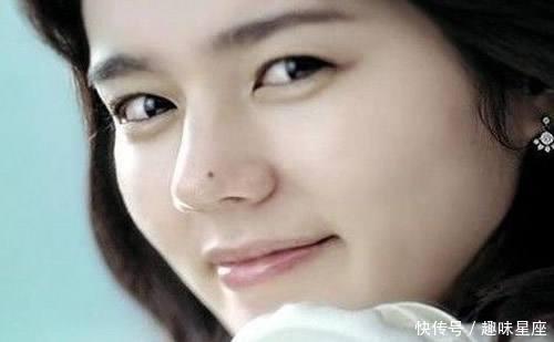 脸上这4个部位有痣,好运爆棚,注定非富即贵