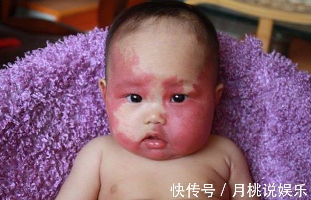 钟无艳|孕期不听劝做了这5件事,将影响宝宝的颜值