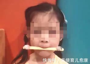 训练|天使科普：揭开“口肌训练”的神秘面纱，它究竟是什么？