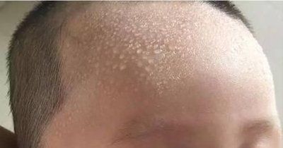 晴晴|夏季来临,小心“热感冒”找上娃,家长做好日常护理,孩子少生病