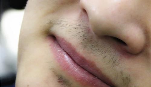 胡须|50岁后雄激素分泌仍旧旺盛的男性，有什么特点？是好事吗？