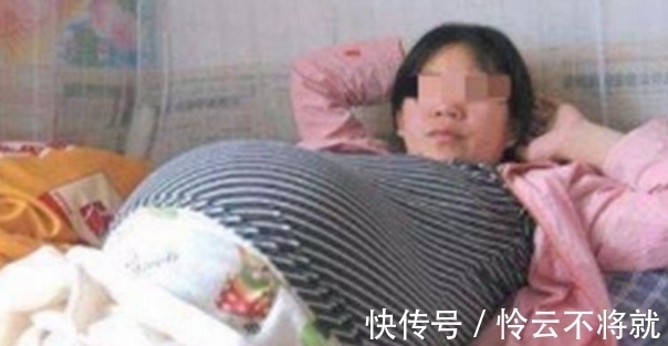 鬼门关|女子顺产后想睡觉,家属察觉不对,叫来医生送手术室