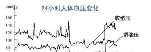 专家|降压药,空腹吃还是餐后吃比较好心血管专家给你一次说清楚