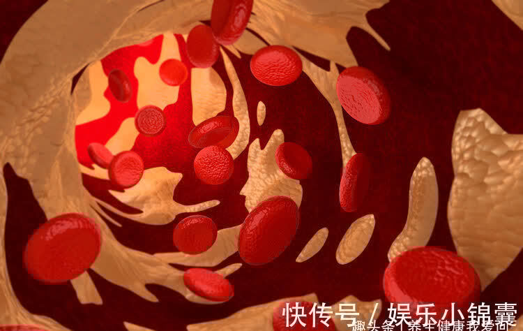 血管狭窄|电子血压计测量血压,是左手还是右手?这些测量小窍门要知道