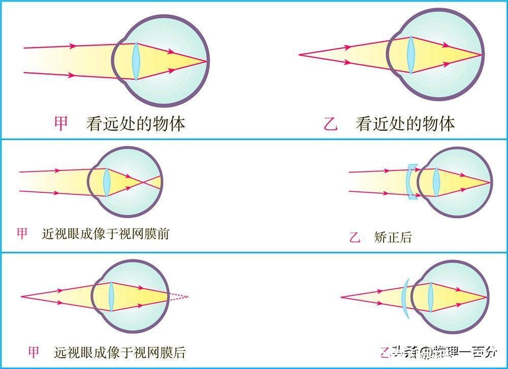 中考物理一轮复习知识方法归纳：近视眼和远视眼的成因与矫正