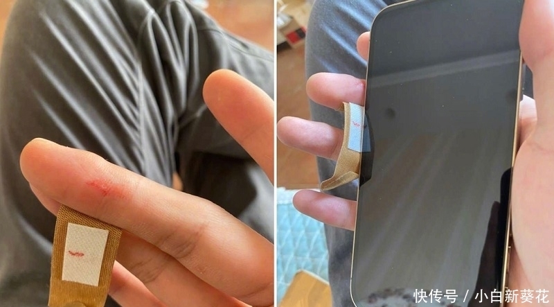 晒图|iPhone12直角边框太锋利，数名果粉集体晒图，手指被割流血