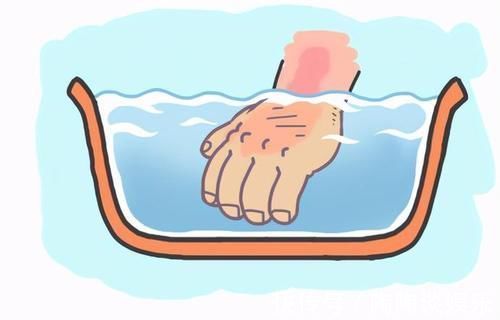 水龙头|孩子被烫伤怎么办?父母学会这4个急救步骤,连医生都会称赞