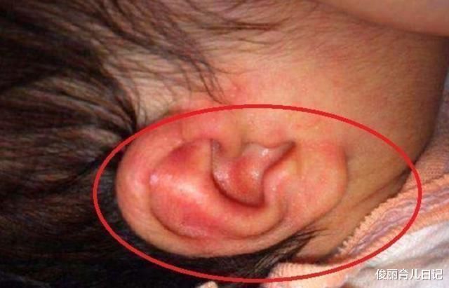 手电筒|男童半夜耳朵疼,妈妈拿灯一照马上去医院,回家立刻丢东西