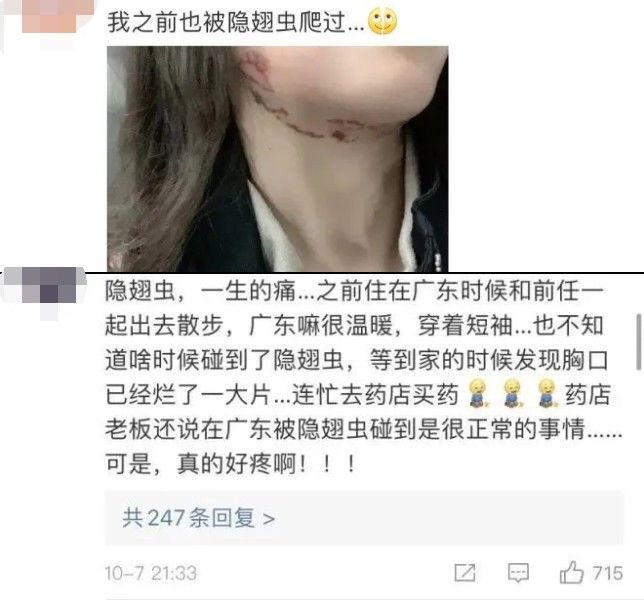隐翅虫|又是它!女子半夜关灯玩手机,险些致毁容……