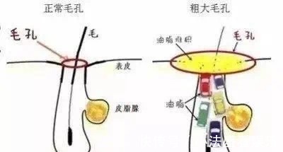 氨基酸洗面奶|把脸打湿,就上洗面奶?做不到“这几点”,别怪毛孔粗大易长痘