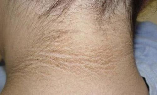 花花|6岁女儿脖颈发黑洗不掉,送医院检查,医生的解释令宝妈哭笑不得