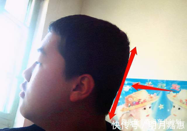 父母|宝宝头型影响身高这种头型的宝宝有“大高个”潜力,父母别嫌丑