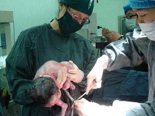 小杨|新生儿出生后的10多分钟,到底在“折腾”些啥其实他比妈妈忙