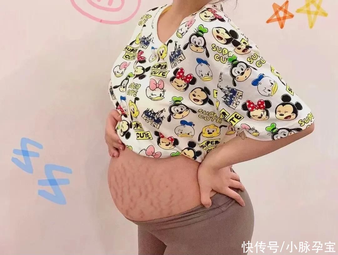 孕育|妊娠纹、大肚腩、大粗腿...那又怎样？我孕育了一个宝宝