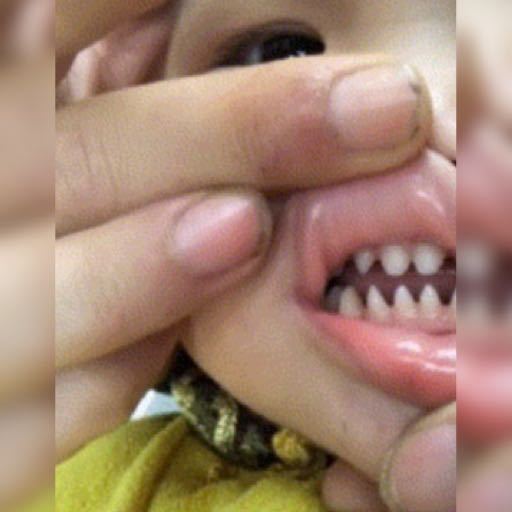 牙齿|萌娃张口的一瞬间令人诧异,牙齿像“鲨鱼牙”,网友父母惹的祸