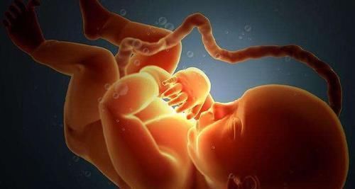 宝妈|胎儿为什么会脐带绕颈多数人以为是受睡姿影响,真相让人意外