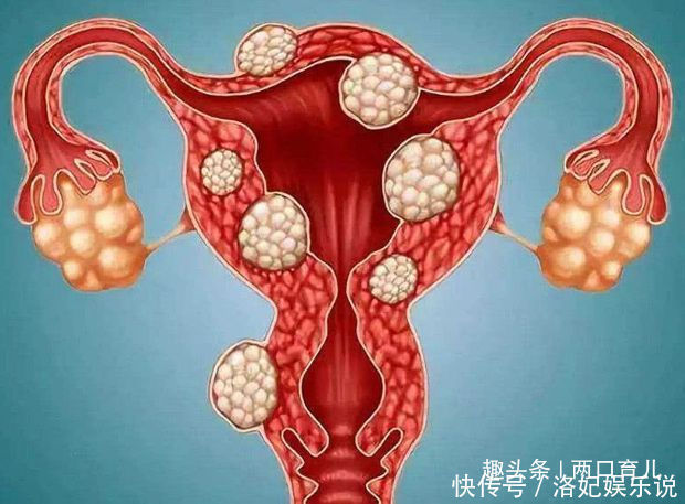 泡水|它被称为“天然黄体酮”,每天用它泡水喝,对女人的好处尤其多