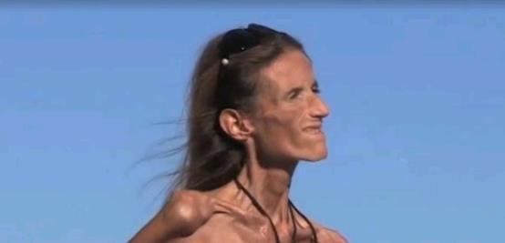 厌食|中餐治厌食,外国女孩爱上火锅,感谢中国育肥成功