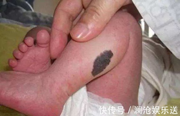 后生|孕妇十月怀胎后生下个“藏獒”,医生得知原因后,怒斥孕妇没人性