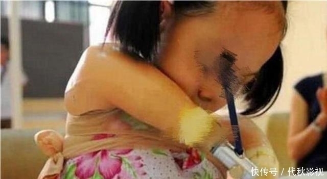 缺陷|怀孕七个月被查出没手脚,宝妈生下后被吓晕,如今孩子活成公主