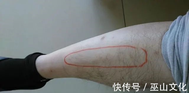 运动|血脂高不高,看小腿就懂若有这4种症状,或在暗示血脂偏高了