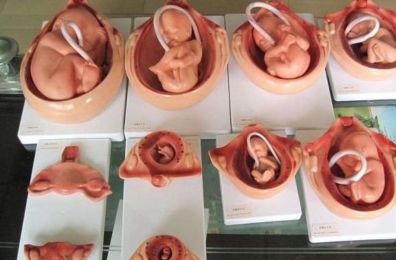 怀孕|怀孕8个月,老婆就生下了宝宝,丈夫:这是亲生的?